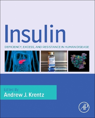 Insulin: Deficiency, Excess and Resistance in Human Disease