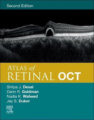 Atlas of Retinal OCT E-Book: Optical Coherence Tomography
