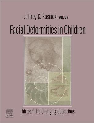 Facial Deformities in Children - E-Book: Facial Deformities in Children - E-Book