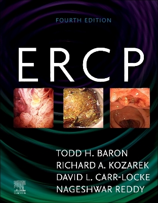 ERCP E-Book