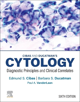 Cibas and Ducatman's Cytology E-Book: Cibas and Ducatman's Cytology E-Book