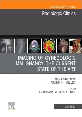 Imaging of Gynecologic Malignancy: The Current State of the Art, An Issue of  Radiologic Clinics of North America, Volume 61-4