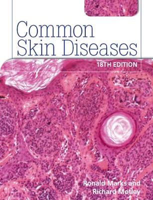 Common Skin Diseases 18th edition: ISE 18th edition