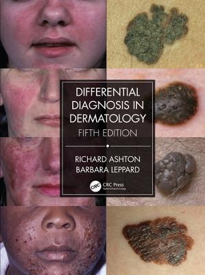 Differential Diagnosis in Dermatology 5th edition