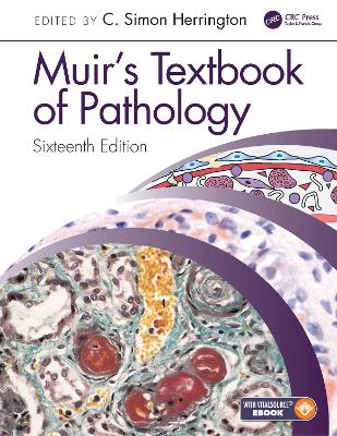 Muir's Textbook of Pathology: Sixteenth Edition International Student Edition 16th edition
