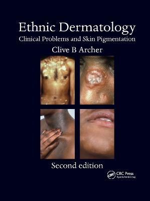 Ethnic Dermatology: Clinical Problems and Skin Pigmentation 2nd edition