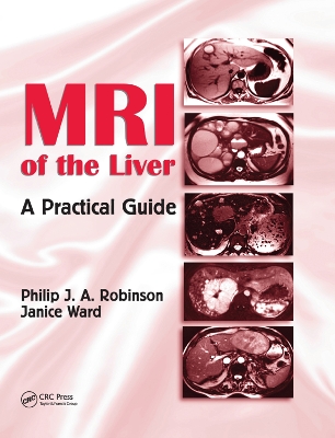 MRI of the Liver: A Practical Guide