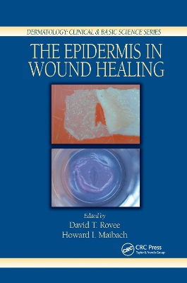 Epidermis in Wound Healing