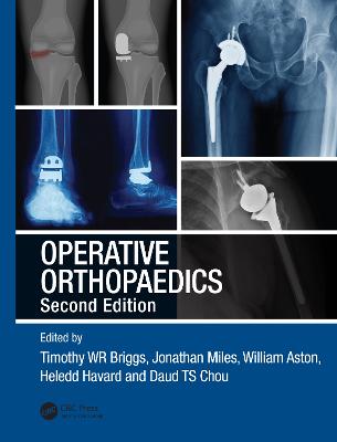 Operative Orthopaedics: The Stanmore Guide 2nd edition