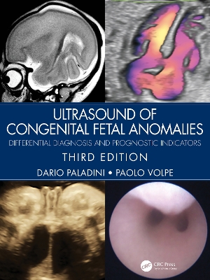 Ultrasound of Congenital Fetal Anomalies: Differential Diagnosis and Prognostic Indicators 3rd edition