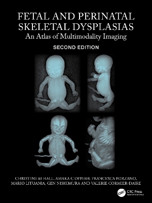 Fetal and Perinatal Skeletal Dysplasias: An Atlas of Multimodality Imaging 2nd edition
