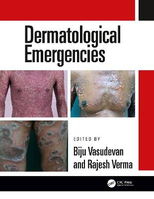 Dermatological Emergencies