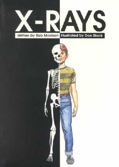 X-Rays