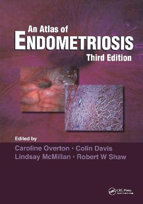 Atlas of Endometriosis 3rd edition