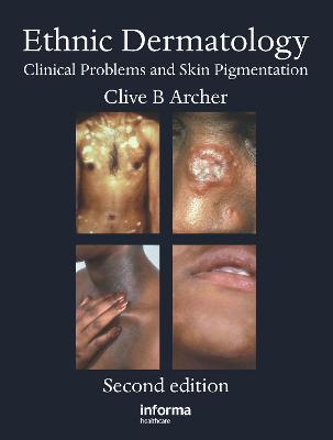 Ethnic Dermatology: Clinical Problems and Skin Pigmentation 2nd edition