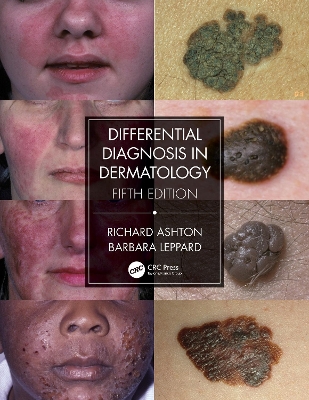 Differential Diagnosis in Dermatology 5th edition
