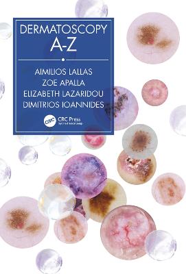 Dermatoscopy A-Z