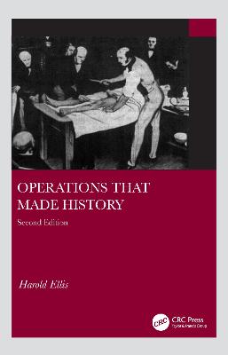 Operations that made History 2e