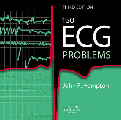 150 ECG Problems 3rd Revised edition