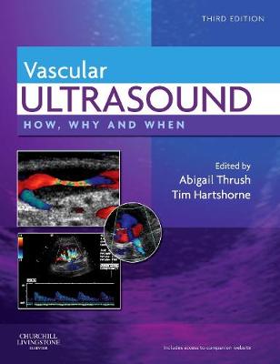 Vascular Ultrasound: How, Why and When 3rd edition
