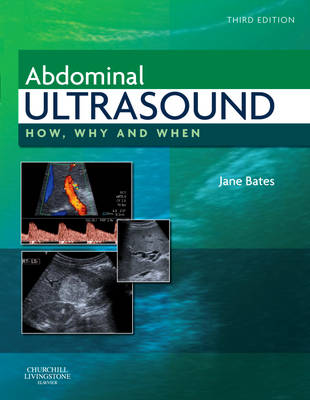 Abdominal Ultrasound: How, Why and When 3rd edition