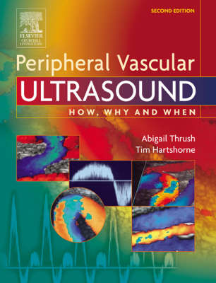 Peripheral Vascular Ultrasound 2nd Revised edition