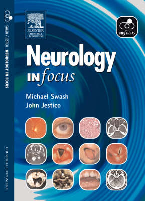 Neurology in Focus