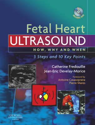 Fetal Heart Ultrasound: How, Why and When