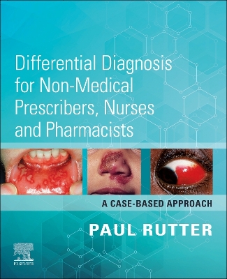 Differential Diagnosis for Non-medical Prescribers, Nurses and Pharmacists: A Case-Based Approach - E-BOOK: Differential Diagnosis for Non-medical Prescribers, Nurses and Pharmacists: A Case-Based Approach - E-BOOK