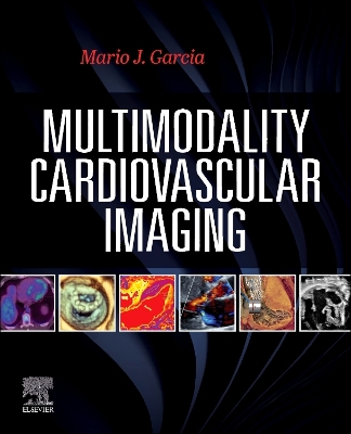 Multimodal Cardiac Imaging - E-Book