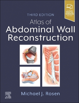 Atlas of Abdominal Wall Reconstruction 3rd edition