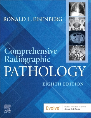 Comprehensive Radiographic Pathology - E-BOOK: Comprehensive Radiographic Pathology - E-BOOK