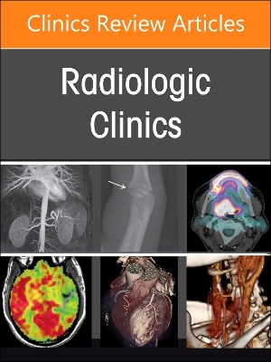 Spine Imaging and Intervention, An Issue of Radiologic Clinics of North  America, Volume 62-2