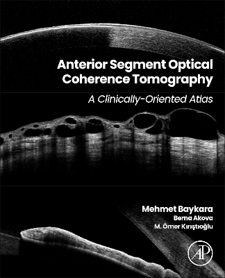 Anterior Segment Optical Coherence Tomography: A Clinically-Oriented Atlas