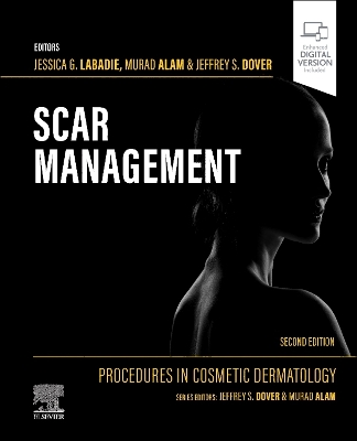 Procedures in Cosmetic Dermatology: Scar Management 2nd edition