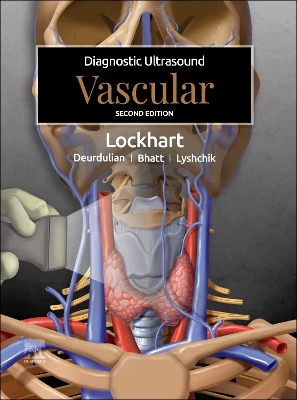 Diagnostic Ultrasound: Vascular - E-book