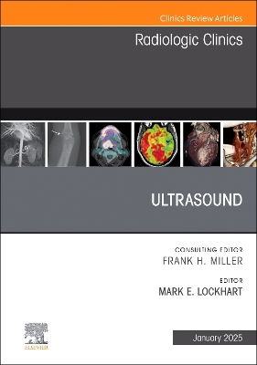 Ultrasound, An Issue of Radiologic Clinics of North America, Volume 63-1
