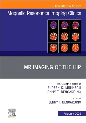 MR Imaging of the Hip, An Issue of Magnetic Resonance Imaging Clinics of North America: MR Imaging of the Hip, An Issue of Magnetic Resonance Imaging Clinics of North America, E-Book