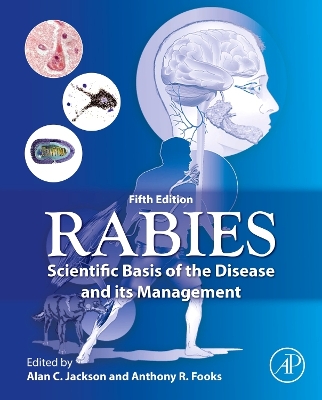 Rabies: Scientific Basis of the Disease and Its Management 5th edition