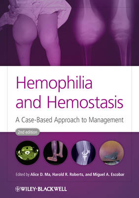 Hemophilia and Hemostasis: A Case-Based Approach to Management 2nd edition