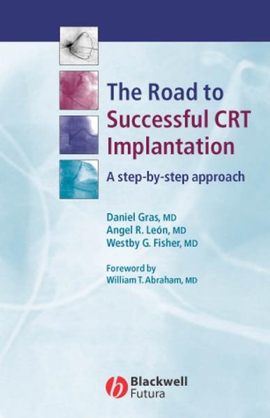 Road to Successful CRT Implantation: A Step-by-Step Approach