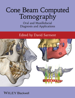 Cone Beam Computed Tomography - Oral and Maxillofacial Diagnosis and   Applications: Oral and Maxillofacial Diagnosis and Applications