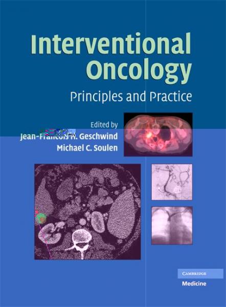 Interventional Oncology: Principles and Practice