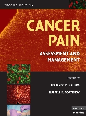 Cancer Pain: Assessment and Management 2nd Revised edition