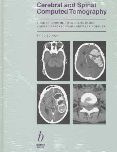Cerebral and Spinal Computed Tomography 3rd Revised edition