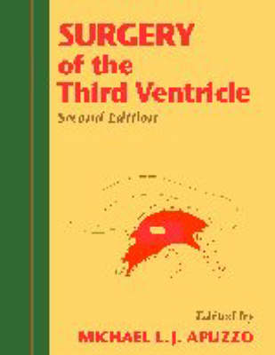 Surgery of the Third Ventricle 2nd Revised edition