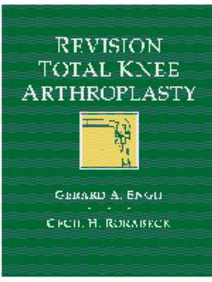 Revision Total Knee Arthroplasty 1997 ed.