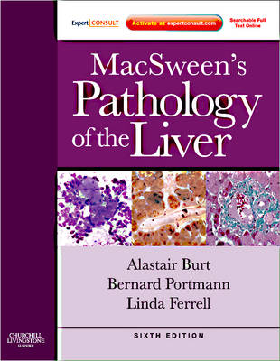 MacSween's Pathology of the Liver 6th Revised edition