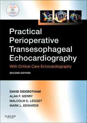 Practical Perioperative Transesophageal Echocardiography: Text with DVD-ROM 2nd Revised edition