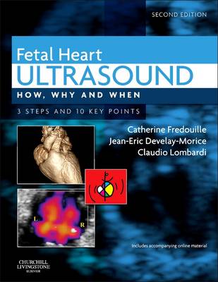 Fetal Heart Ultrasound: How, Why and When 2nd Revised edition